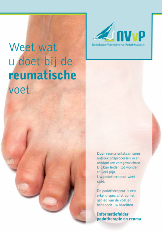 Weet wat u doet bij de reumatische voet